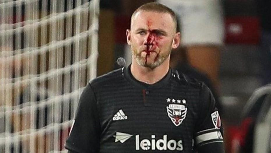 Rooney - MLS accidente