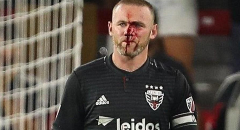 Rooney - MLS accidente