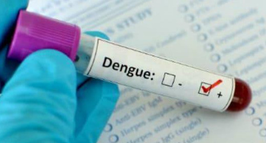 Dengue, análisis en laboratorio, estudios