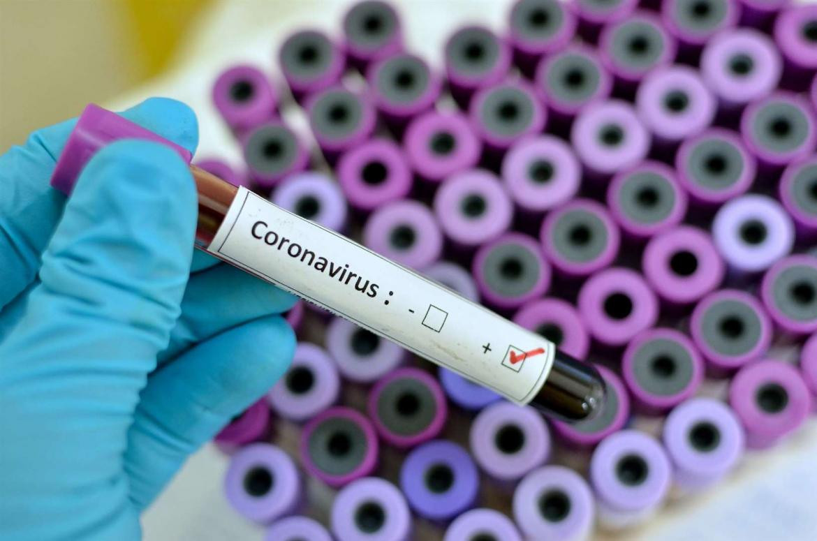 Coronavirus, COVID-19, hospitales, estudios médicos, enfermedad