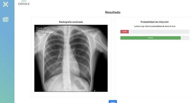 Coronavirus, Argentina, programa detecta COVID19