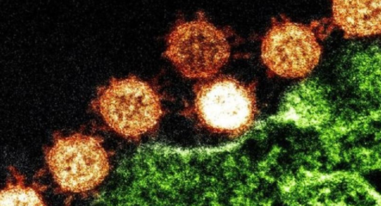 Coronavirus en el mundo, foto artística