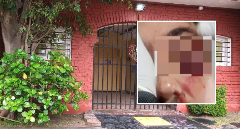 Habló la mujer del hombre golpeado tras una discusión en un "chat de mamis": “Lo patearon en el piso”	