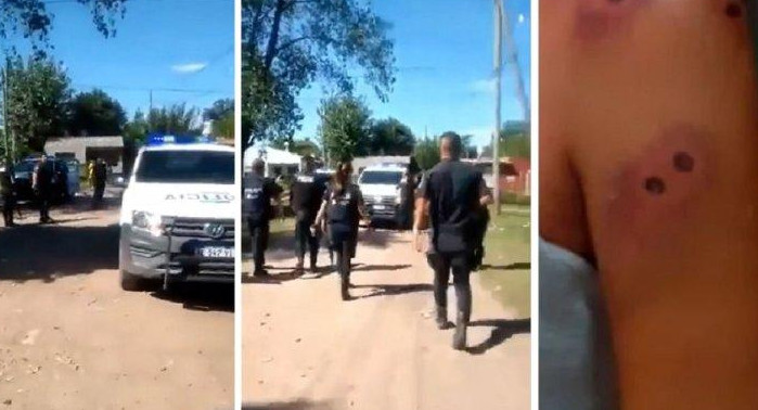 Agresión a beba por policías