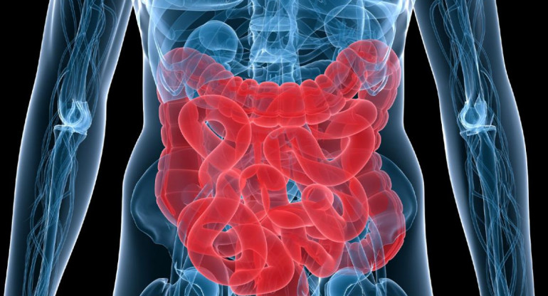 Cáncer de colon, foto IBBiotech