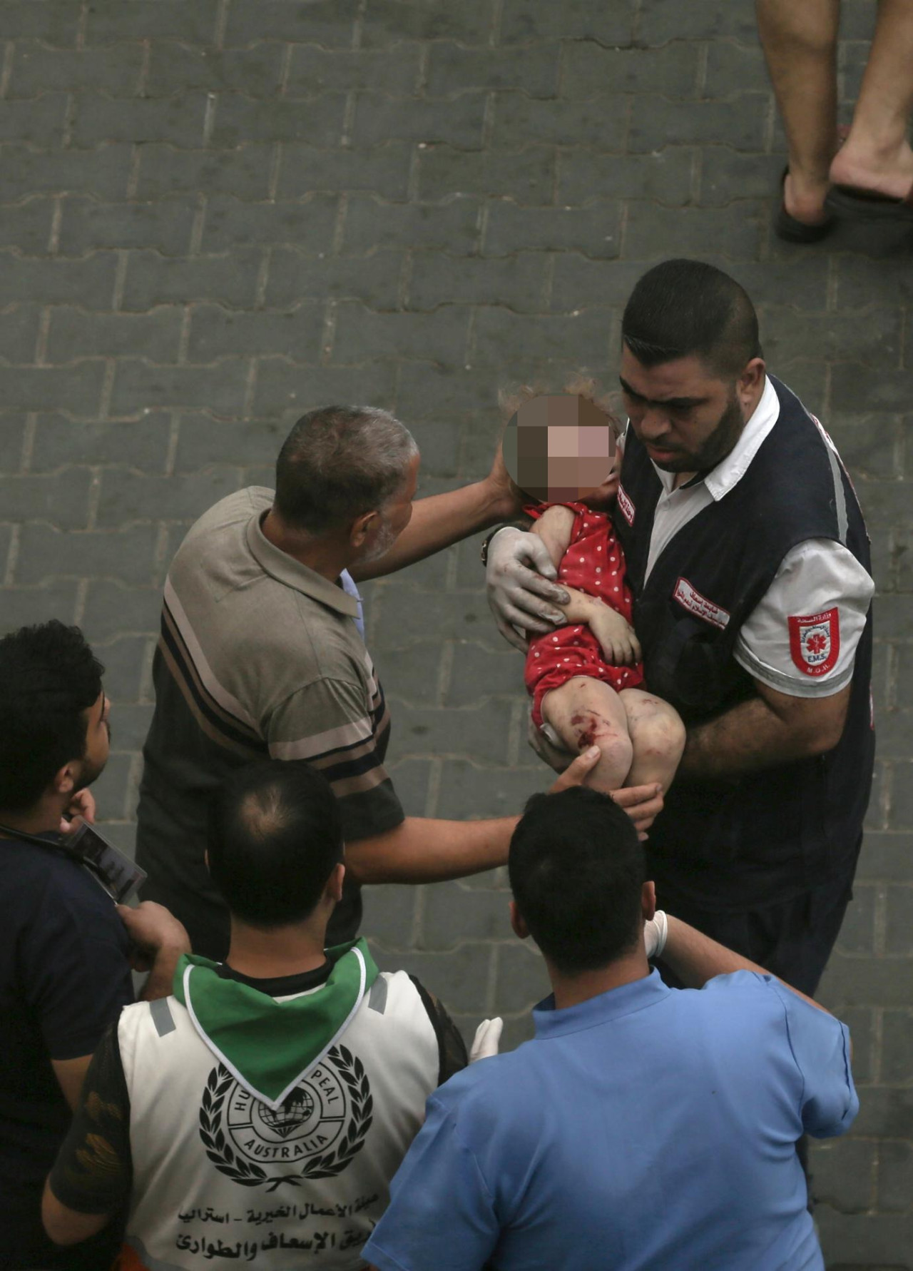 Palestinos se atienden en hospitales de Gaza. Foto: Reuters.