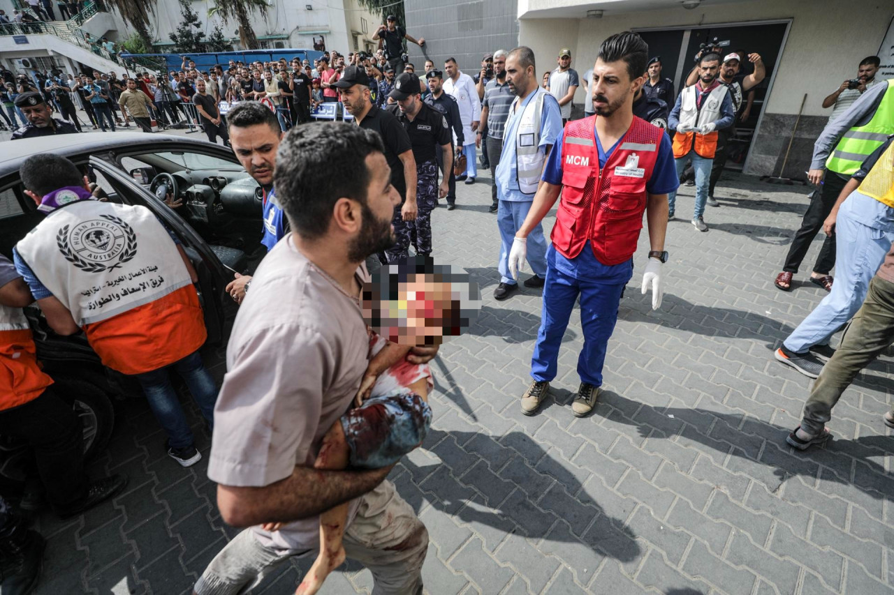 Palestinos se atienden en hospitales de Gaza. Foto: Reuters.