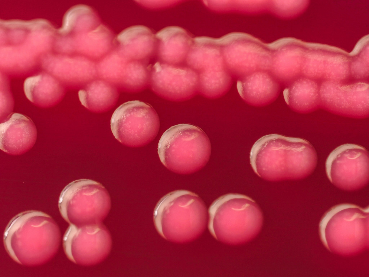 Bacterias de escherichia coli. Foto: Unsplash