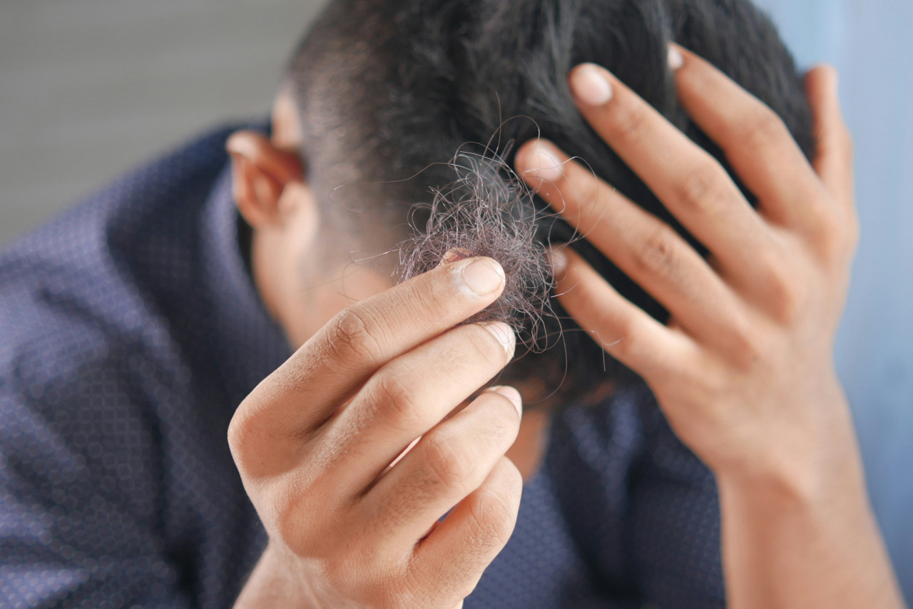 Caída de cabello. Foto: Unsplash