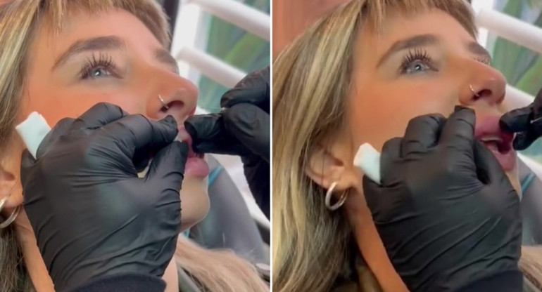 Paloma mostró "las pelotitas" que le sacaron de sus labios. Foto: capturas de video