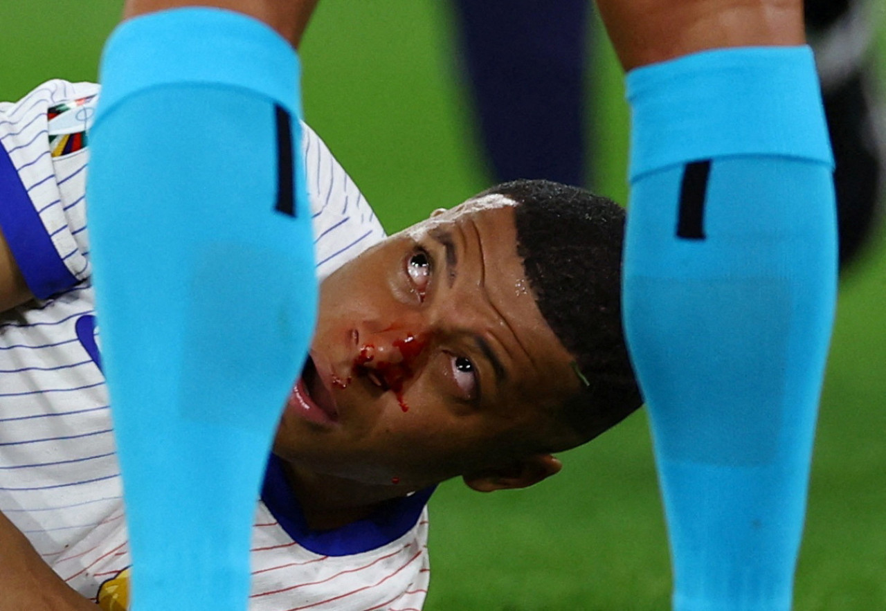 Mbappé se fracturó la nariz en el debut de Francia en la Eurocopa. Foto: Reuters