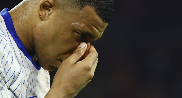 Mbappé se fracturó la nariz en el debut de Francia en la Eurocopa. Foto: Reuters