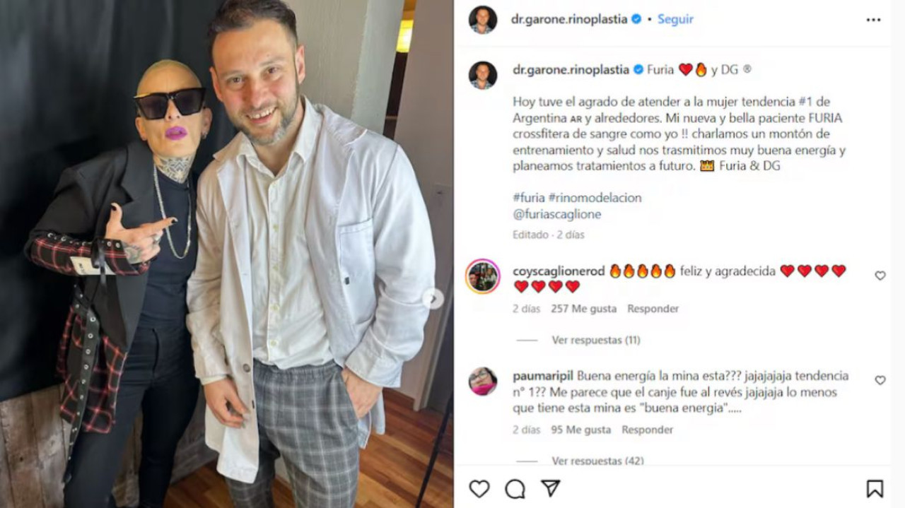 Furia va a realizarse una cirugía estética. Foto: Instagram / dr.garone.rinoplastia