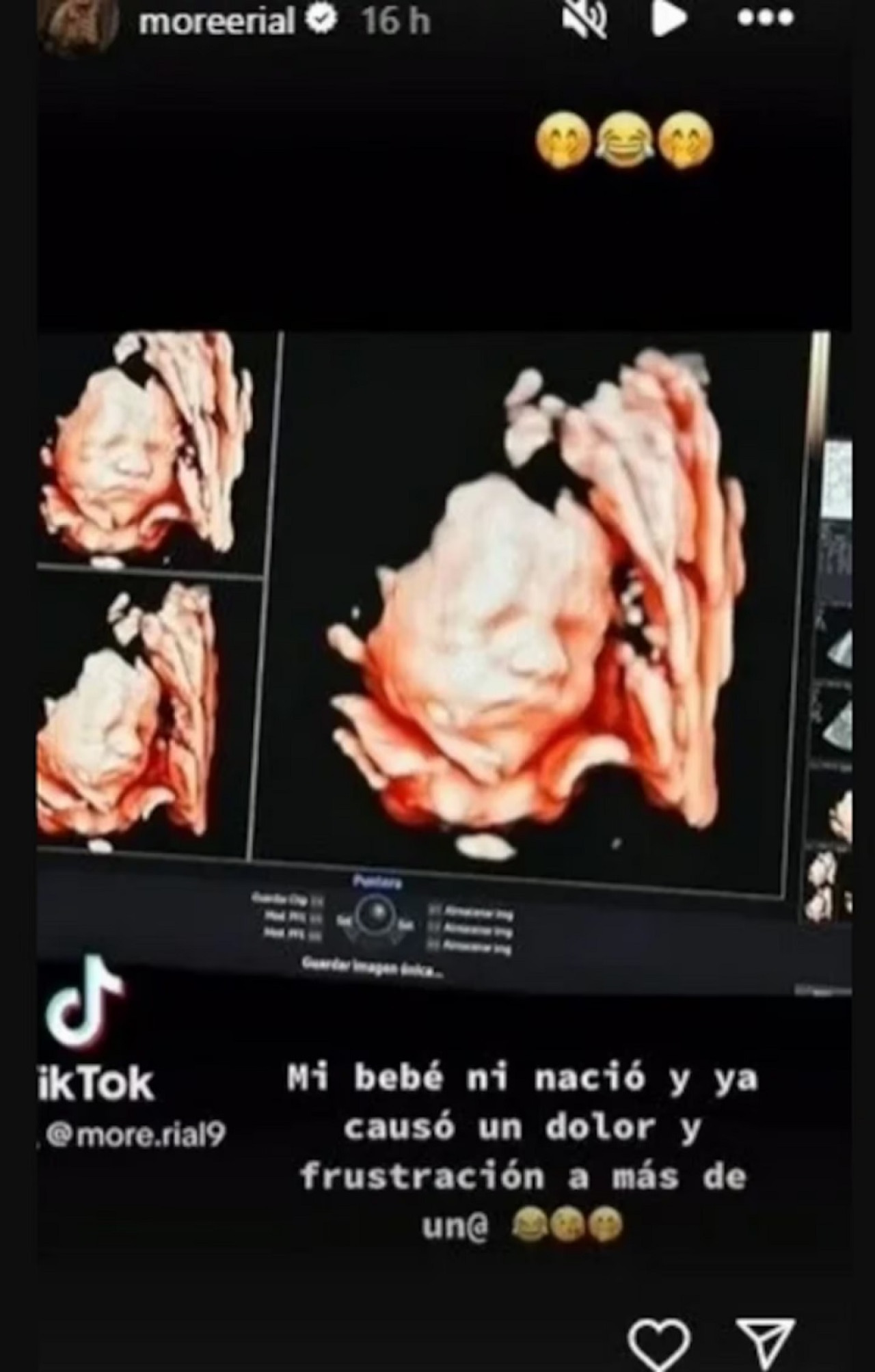 La indirecta de More Rial en la ecografía de su hijo. Foto: TikTok @more.rial9.