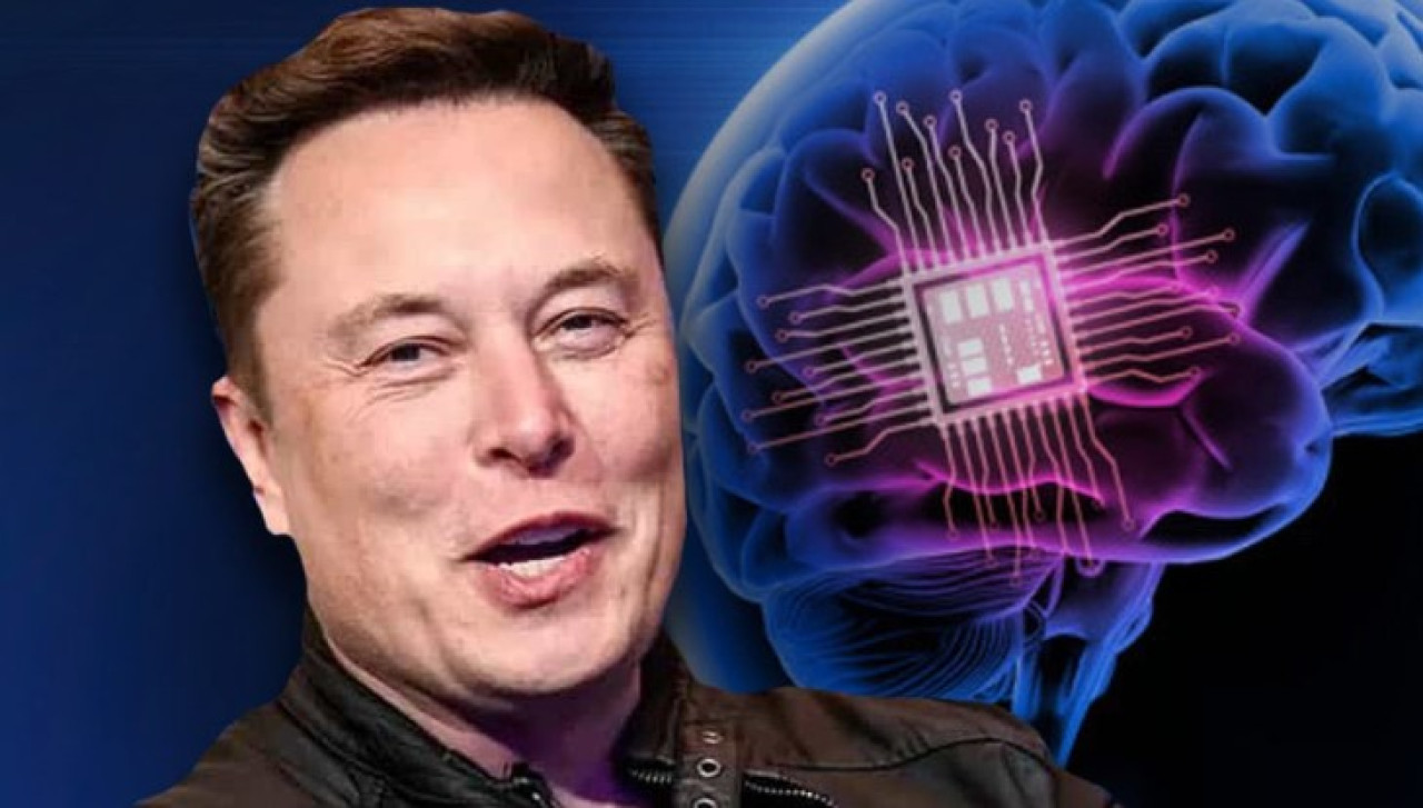 ¿Cómo será el chip de Neuralink que le devolverá la vista a los ciegos congénitos?, según Elon Musk . Foto: X