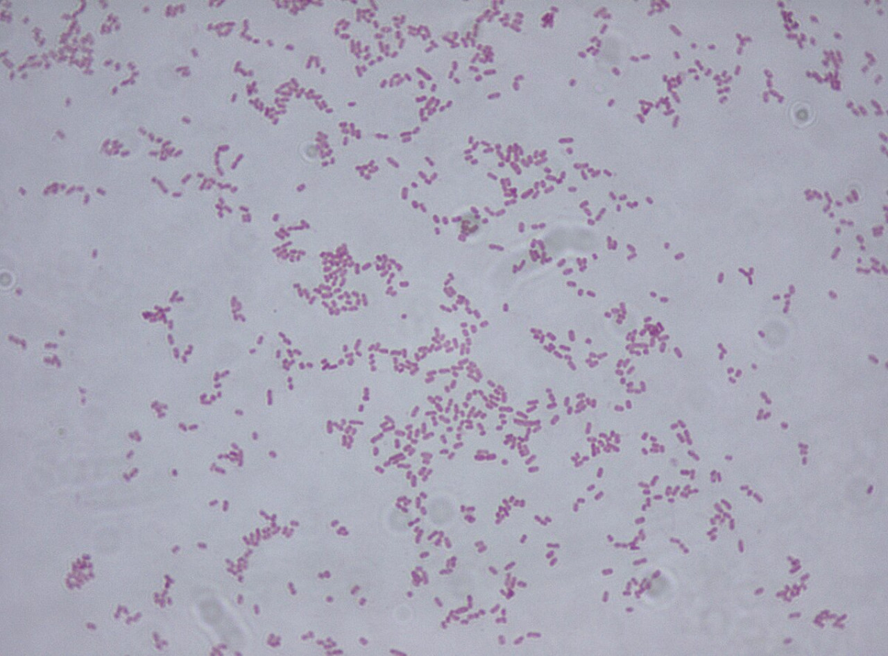 Bacteria Klebsiella oxytoca.