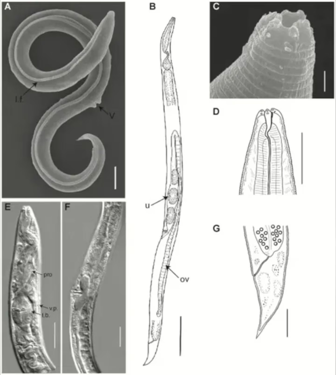 El gusano vivió hace 46.000 años en Siberia. Foto: lavanguardia.com/PLOS Genetics.